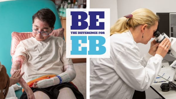 BE the difference for EB