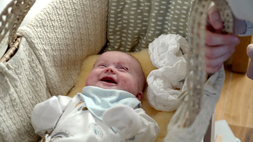 Baby Albi lying in his crib smiling. The bottom of his crib is covered by a sheepskin liner to protect his fragile skin.