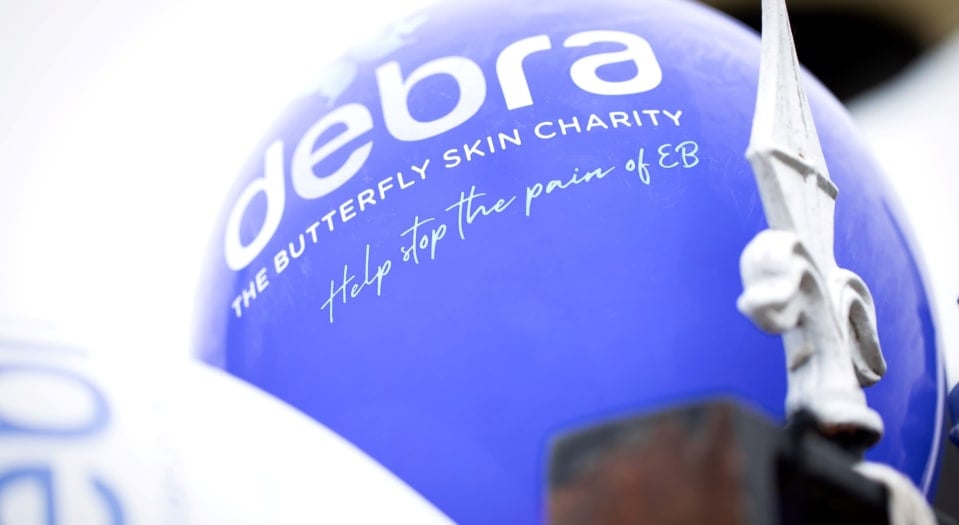 Balloons with DEBRAs logo