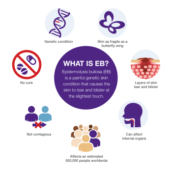 What is EB? infographic. Copyright DEBRA UK